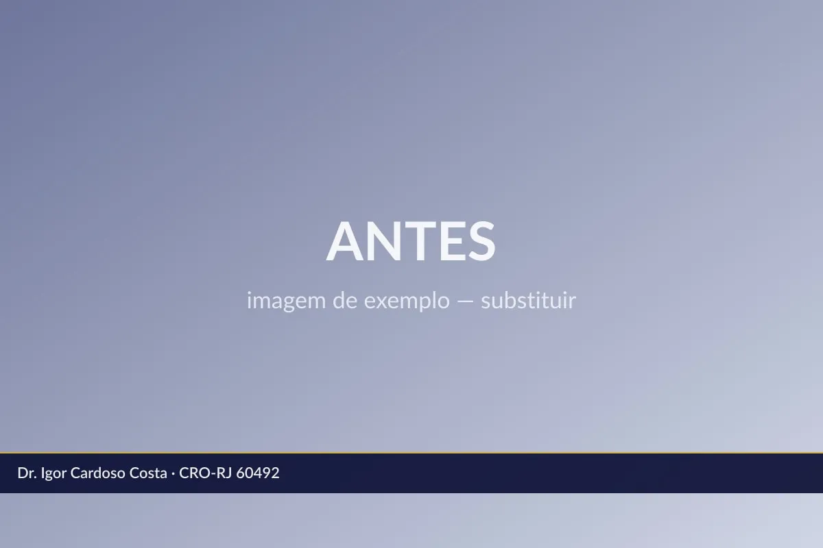 Antes do tratamento: Exemplo de comparação periodontal