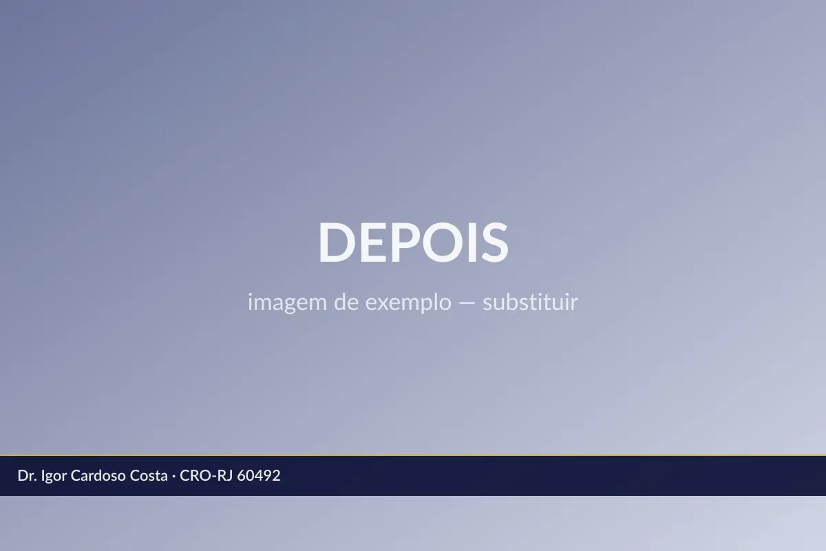 Depois do tratamento: Exemplo de comparação periodontal